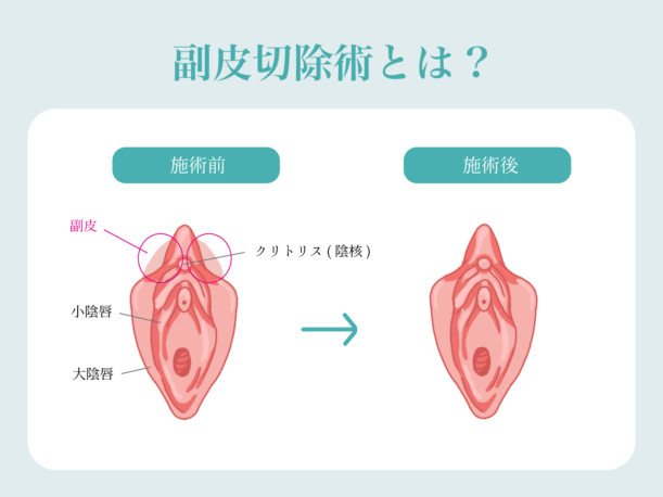 女性器整形婦人科形成 | ガーデンクリニック 美容外科・美容整形