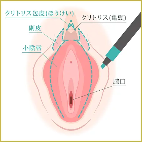 クリトリスの皮を剥くコツは？クリイキするための正しい剥き方をイラストでチェック