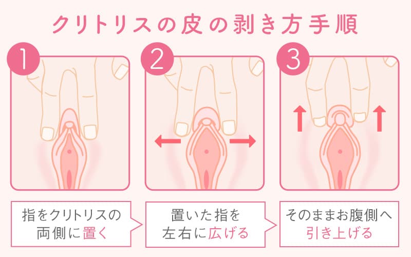 クリトリス(陰核)包茎｜美容外科・美容整形なら宮崎・大分・東京の経験豊富なコムロクリニック