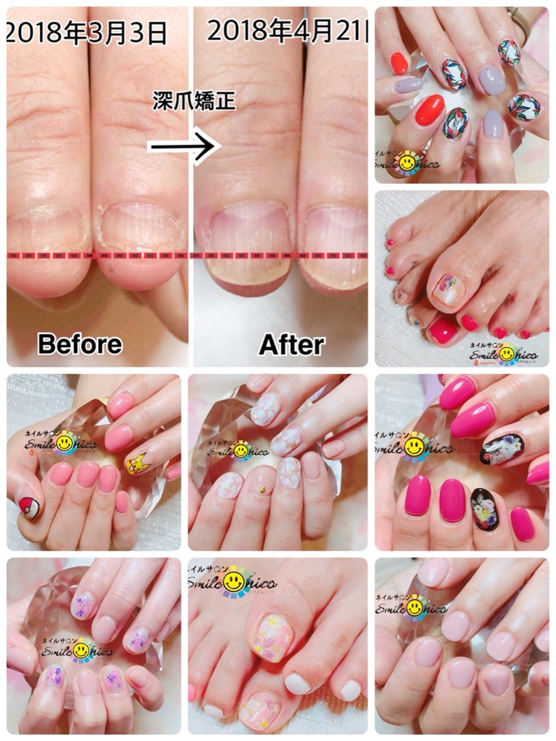 お客様ワンホンネイル🩵 . . . nail