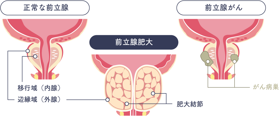 毎回、楽しく講師の私自身も勉強になる前立腺開発講習やって来た！の巻 : † Another