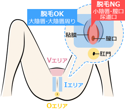 ハイジニーナ脱毛で後悔した？VIOをパイパンにした女性601人の本音調査！ | ミツケル