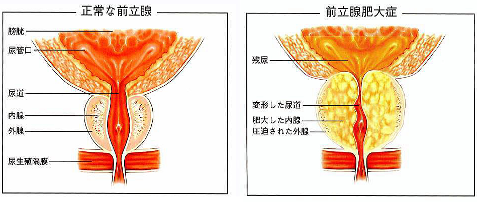 前立腺責めのやり方とコツ！気持ちいい前立腺マッサージの方法をイラストで解説